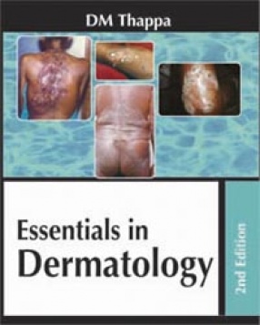 Essentials in Dermatology 