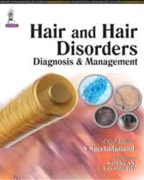 Hair and Hair Disorders Diagnosis and Management