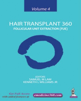 Hair Transplant 360 Follicular Unit Extraction (FUE), Volume 4 