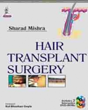 Hair Transplant Surgery 