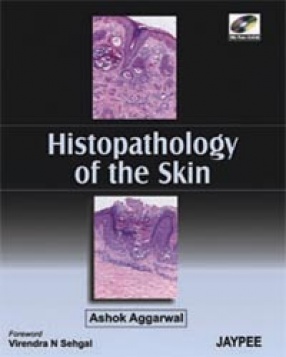 Histopathology of the Skin