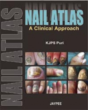 Nail Atlas: A Clinical Approach 