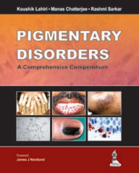 Pigmentary Disorders: A Comprehensive Compendium 