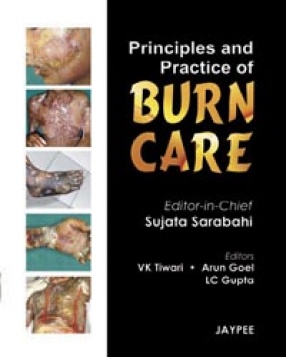 Principles and Practice of Burn Care 