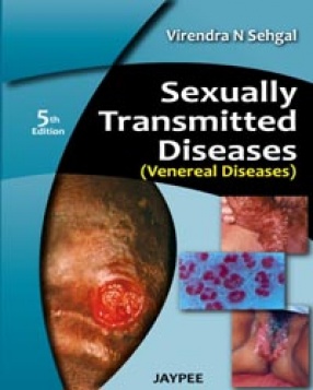 Sexually Transmitted Diseases