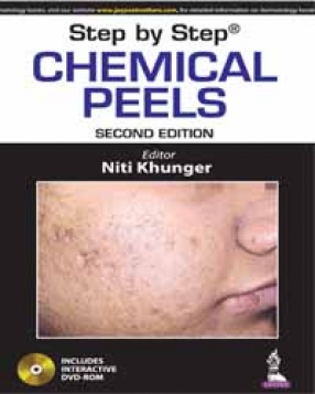 Step By Step Chemical Peels 