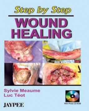 Step by Step Wound Healing