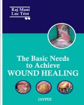 The Basic Needs to Achieve Wound Healing