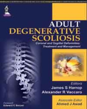Adult Degenerative Scoliosis: Coronal and Sagittal Deformities: Treatment and Management 