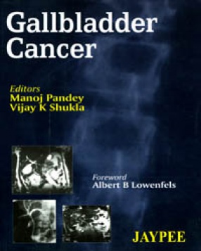 Gallbladder Cancer 