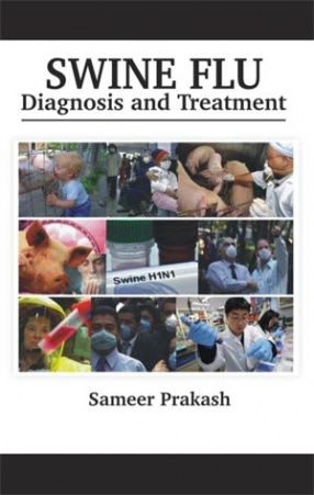 Swine Flu: Diagnosis and Treatment