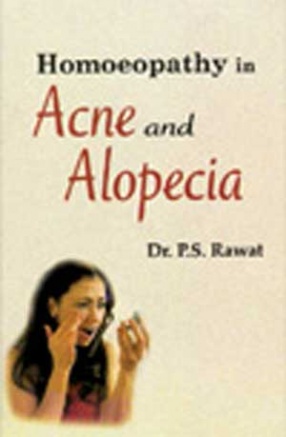 Homoeopathy in Acne and Alopecia