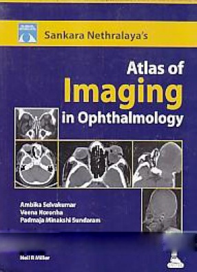 Sankara Nethralaya Atlas of Imaging in Ophthalmology