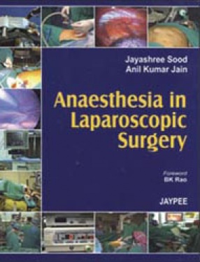 Anaesthesia in Laparoscopic Surgery