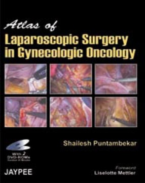 Atlas of Laparoscopic Surgery in Gynecologic Oncology
