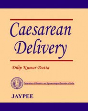 Caesarean Delivery