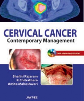 Cervical Cancer Contemporary Management