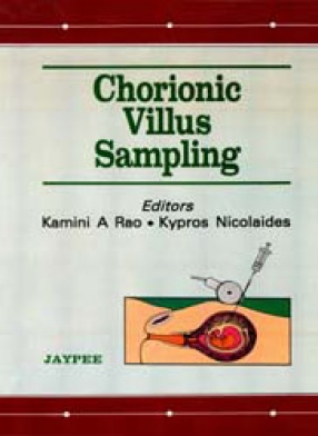 Chorionic Villus Sampling