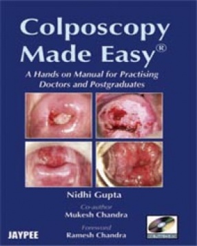 Colposcopy Made Easy