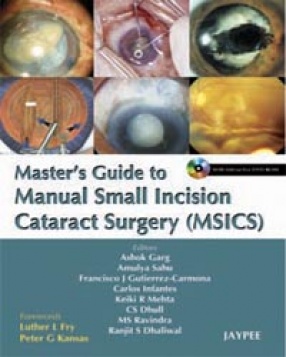 Master's Guide to Manual Small Incision Cataract Surgery