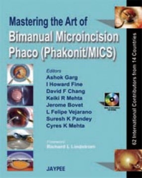 Mastering the Art of Bimanual Microincision Phaco 