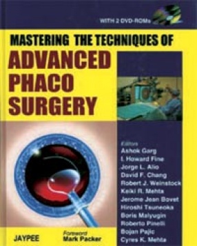 Mastering the Techniques of Advanced Phaco Surgery