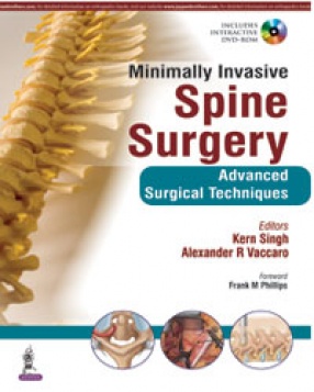 Minimally Invasive Spine Surgery: Advanced Surgical Techniques 