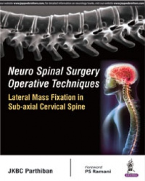 Neuro Spinal Surgery Operative Techniques Lateral Mass Fixation in Sub-Axial Cervical Spine 