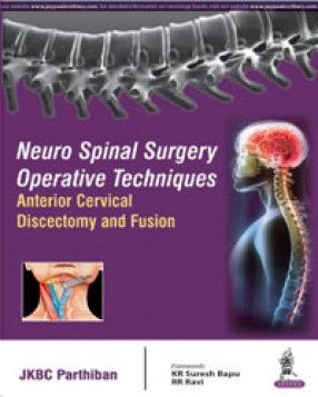 Neuro Spinal Surgery Operative Techniques: Anterior Cervical Discectomy and Fusion 