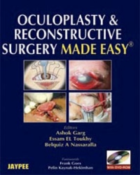Oculoplasty & Reconstructive Surgery Made Easy