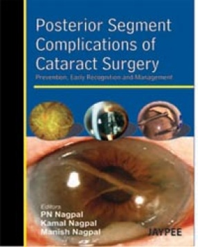 Posterior Segment Complications of Cataract Surgery 