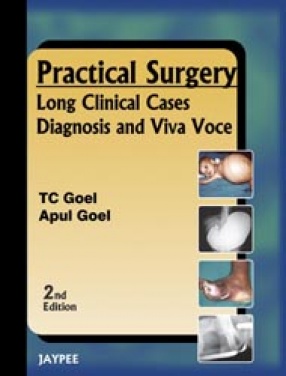 Practical Surgery: Long Clinical Cases-Diagnosis and Viva Voce 