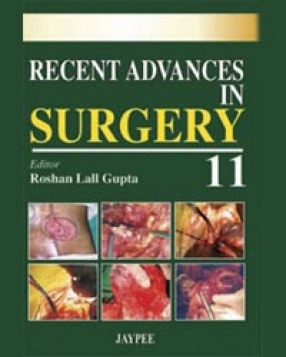 Recent Advances in Surgery, Volume 11