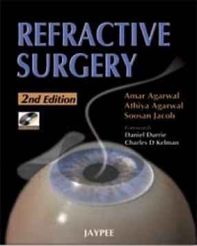 Refractive Surgery 