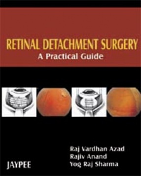 Retinal Detachment Surgery: A Practical Guide 