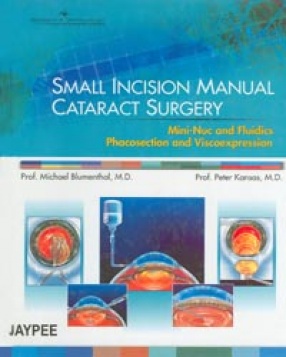 Small Incision Manual Cataract Surgery 