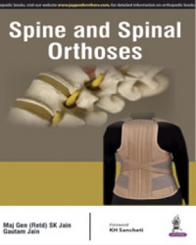 Spine and Spinal Orthoses 