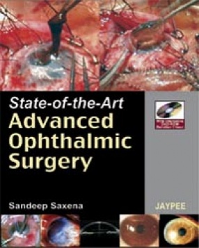 State of the Art Advanced Ophthalmic Surgery