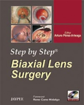 Step by Step Biaxial Lens Surgery 