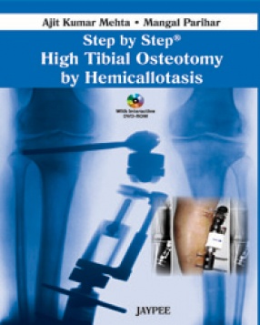 Step by Step High Tibial Osteotomy by Hemicallotasis 