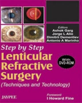 Step by Step Lenticular Refractive Surgery