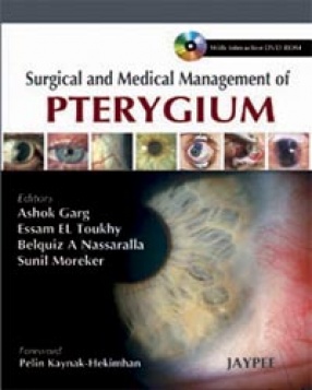 Surgical and Medical Management of Pterygium 