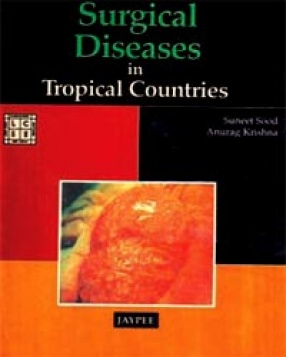 Surgical Diseases in Tropical Countries 