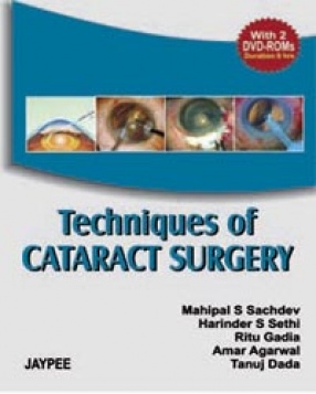 Techniques of Cataract Surgery 