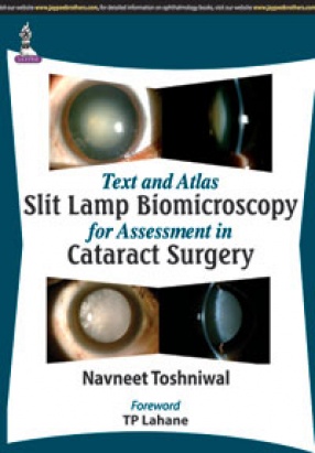 Text and Atlas: Slit Lamp Biomicroscopy for Assessment in Cataract Surgery