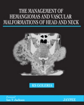 The Management of Hemangiomas and Vascular Malformations of Head and Neck