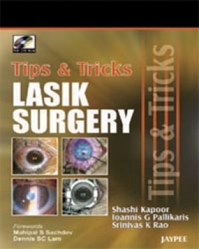 Tips & Tricks in Lasik Surgery 