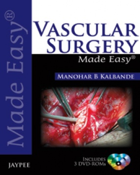 Vascular Surgery Made Easy 