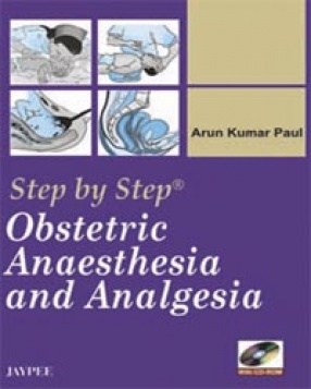 Step by Step Obstetric Anaesthesia and Analgesia