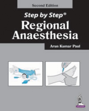 Step by Step Regional Anaesthesia 